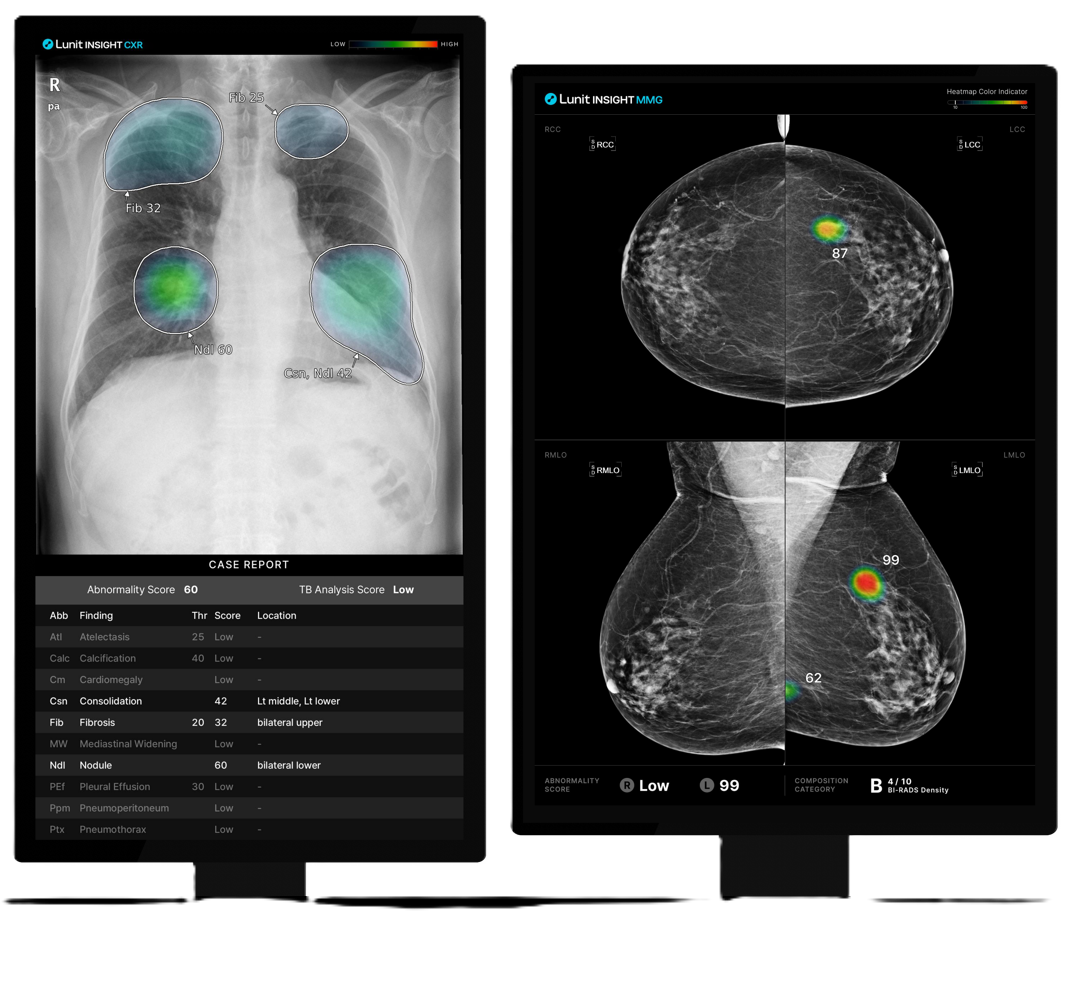 루닛 인사이트 CXR(Lunit INSIGHT CXR), 루닛 인사이트 MMG(Lunit INSIGHT MMG)